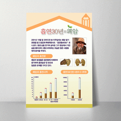H58.흡연30년=폐암